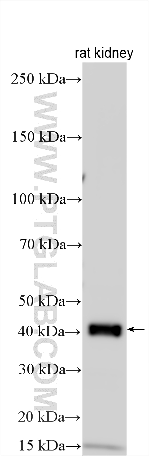 WB analysis using 16101-1-AP WB analysis using 16101-1-AP