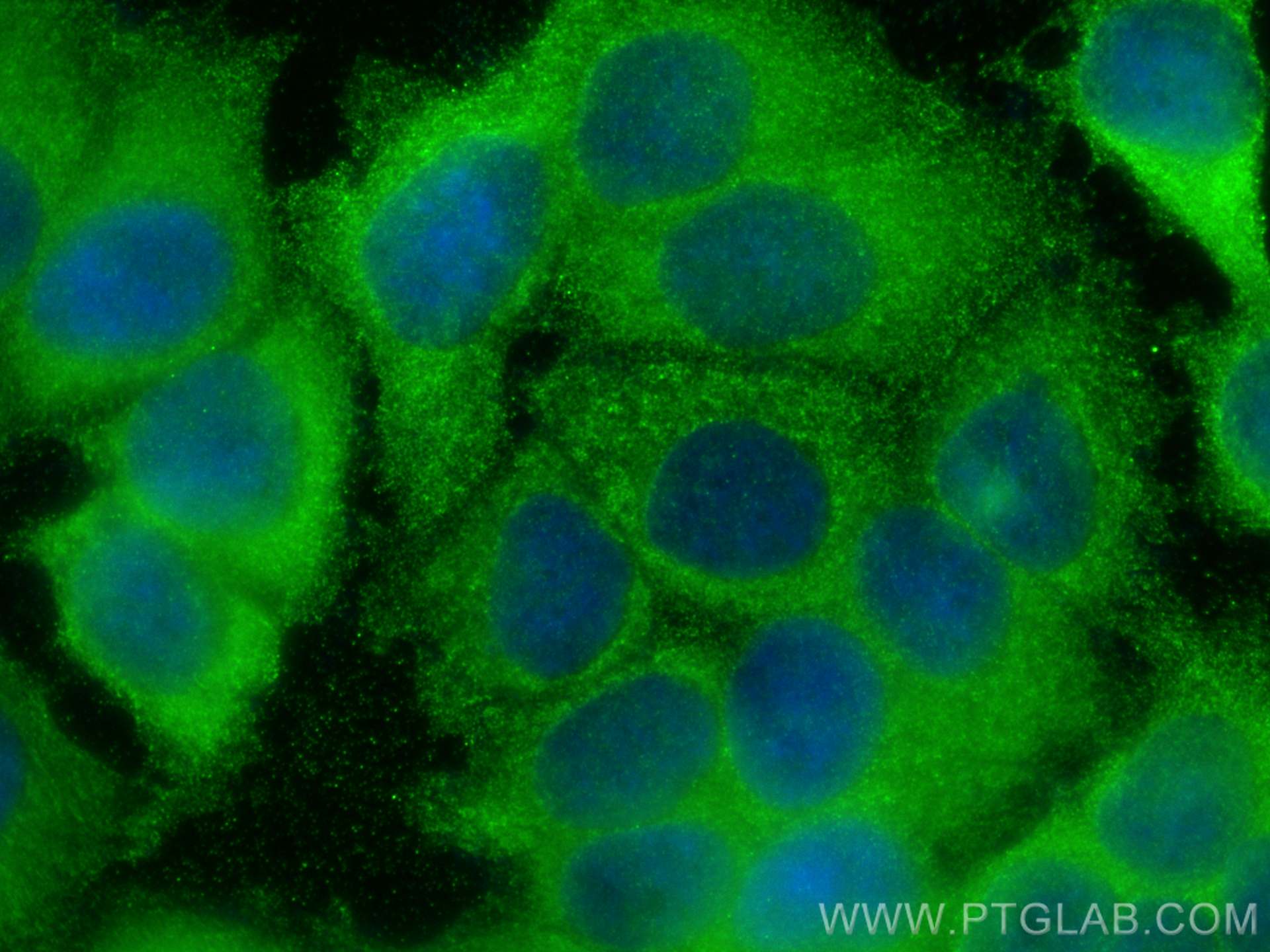 IF Staining of MCF-7 using 16304-1-AP