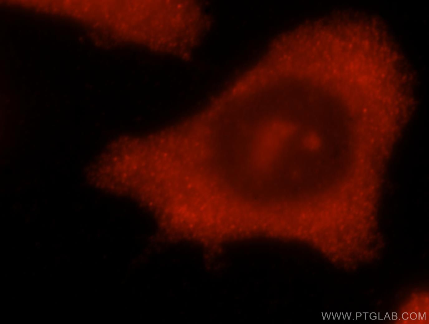 IF Staining of MCF-7 using 16304-1-AP