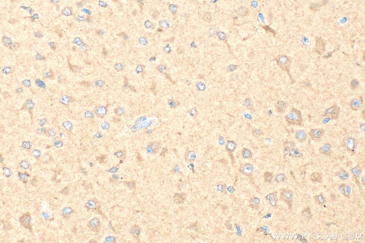 IHC staining of mouse brain using 12963-1-AP