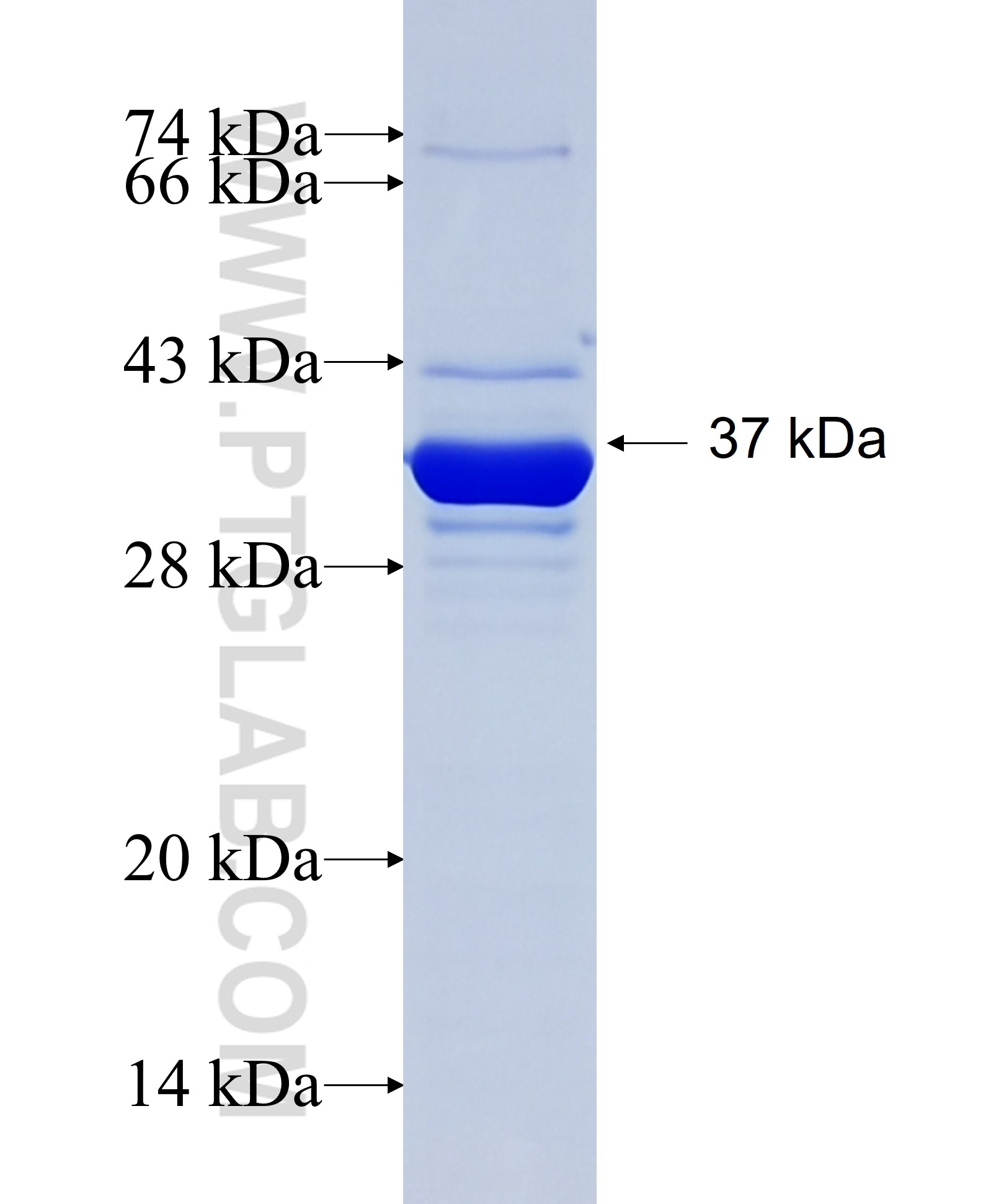 CHAD fusion protein Ag29286 SDS-PAGE CHAD fusion protein Ag29286 SDS-PAGE