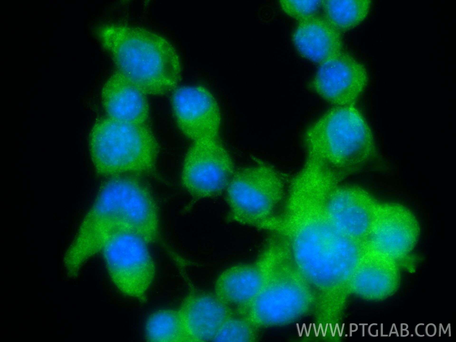 Immunofluorescent analysis of (-20°C Ethanol) fixed Neuro-2a cells using CHAT antibody (20747-1-AP) at dilution of 1:200 and CoraLite®488-Conjugated Goat Anti-Rabbit IgG(H+L) (<a class='green' href='/productredirect?CatalogNo=SA00013-2' target='_blank'>SA00013-2</a>). IF Staining of Neuro-2a using 20747-1-AP
