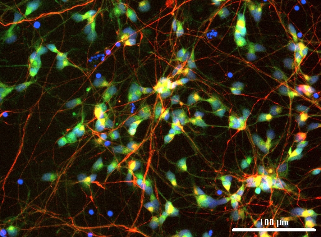 IF Staining of hiPSC-derived reporter spinal motor neurons using 20747-1-AP