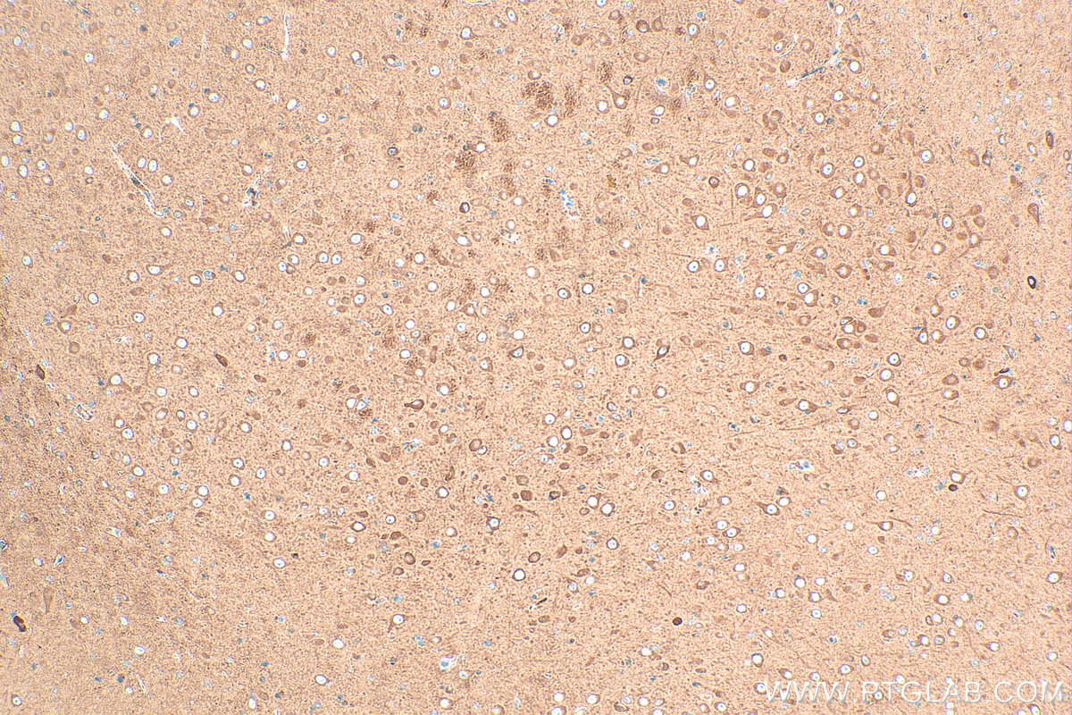 Immunohistochemical analysis of paraffin-embedded rat brain tissue slide using 20747-1-AP (CHAT antibody) at dilution of 1:400 (under 10x lens). Heat mediated antigen retrieval with Tris-EDTA buffer (pH 9.0). IHC staining of rat brain using 20747-1-AP