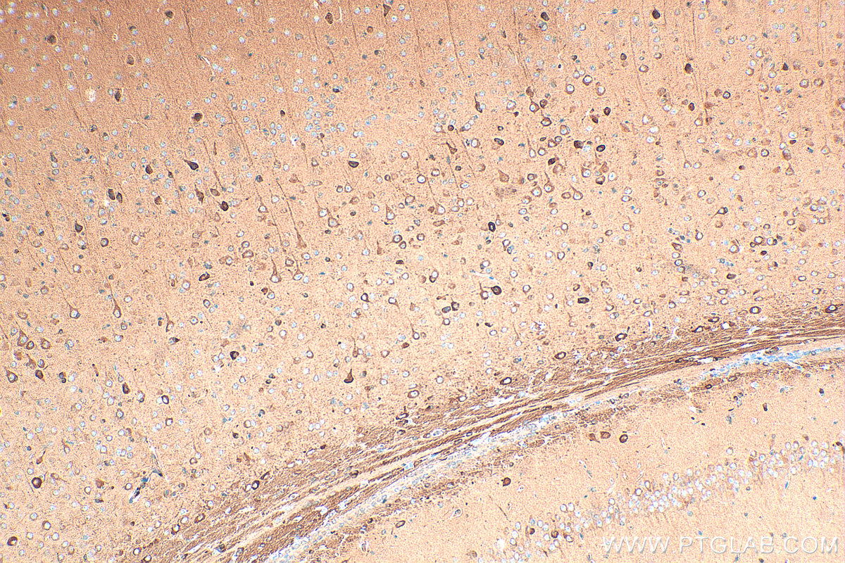 Immunohistochemical analysis of paraffin-embedded mouse brain tissue slide using 20747-1-AP (CHAT antibody) at dilution of 1:400 (under 10x lens). Heat mediated antigen retrieval with Tris-EDTA buffer (pH 9.0). IHC staining of mouse brain using 20747-1-AP