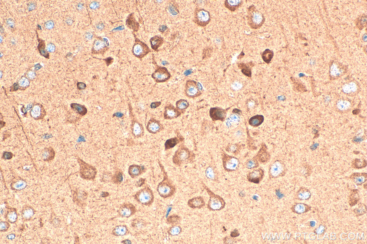 Immunohistochemical analysis of paraffin-embedded mouse brain tissue slide using 20747-1-AP (CHAT antibody) at dilution of 1:400 (under 40x lens). Heat mediated antigen retrieval with Tris-EDTA buffer (pH 9.0). IHC staining of mouse brain using 20747-1-AP