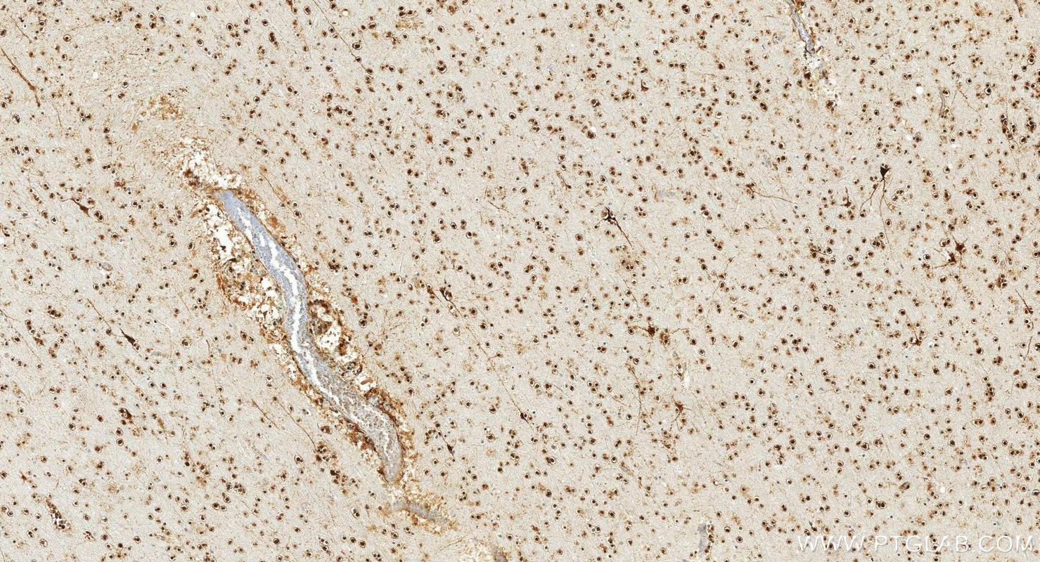 IHC staining of human brain using 20747-1-AP (same clone as 20747-1-PBS) IHC staining of human brain using 20747-1-AP (same clone as 20747-1-PBS)