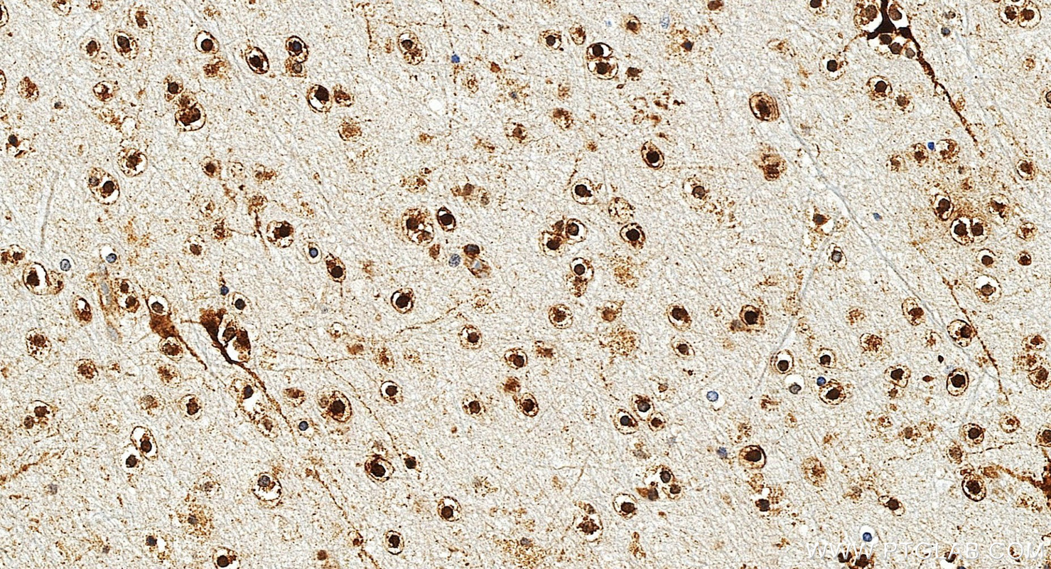 IHC staining of human brain using 20747-1-AP