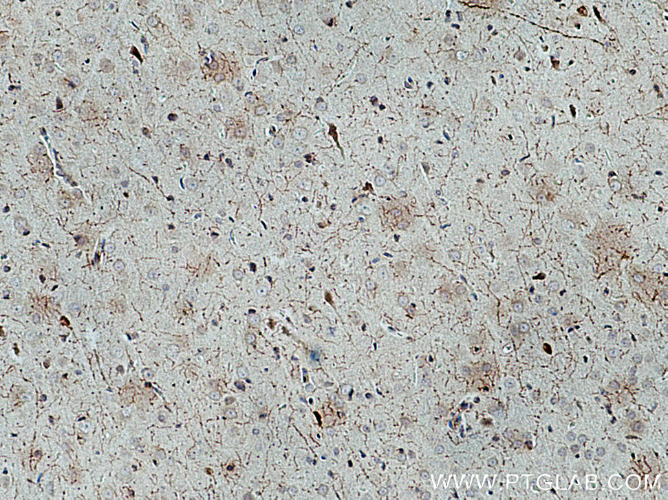 IHC staining of rat brain using 24418-1-AP