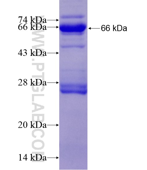 CHAT fusion protein Ag19550 SDS-PAGE