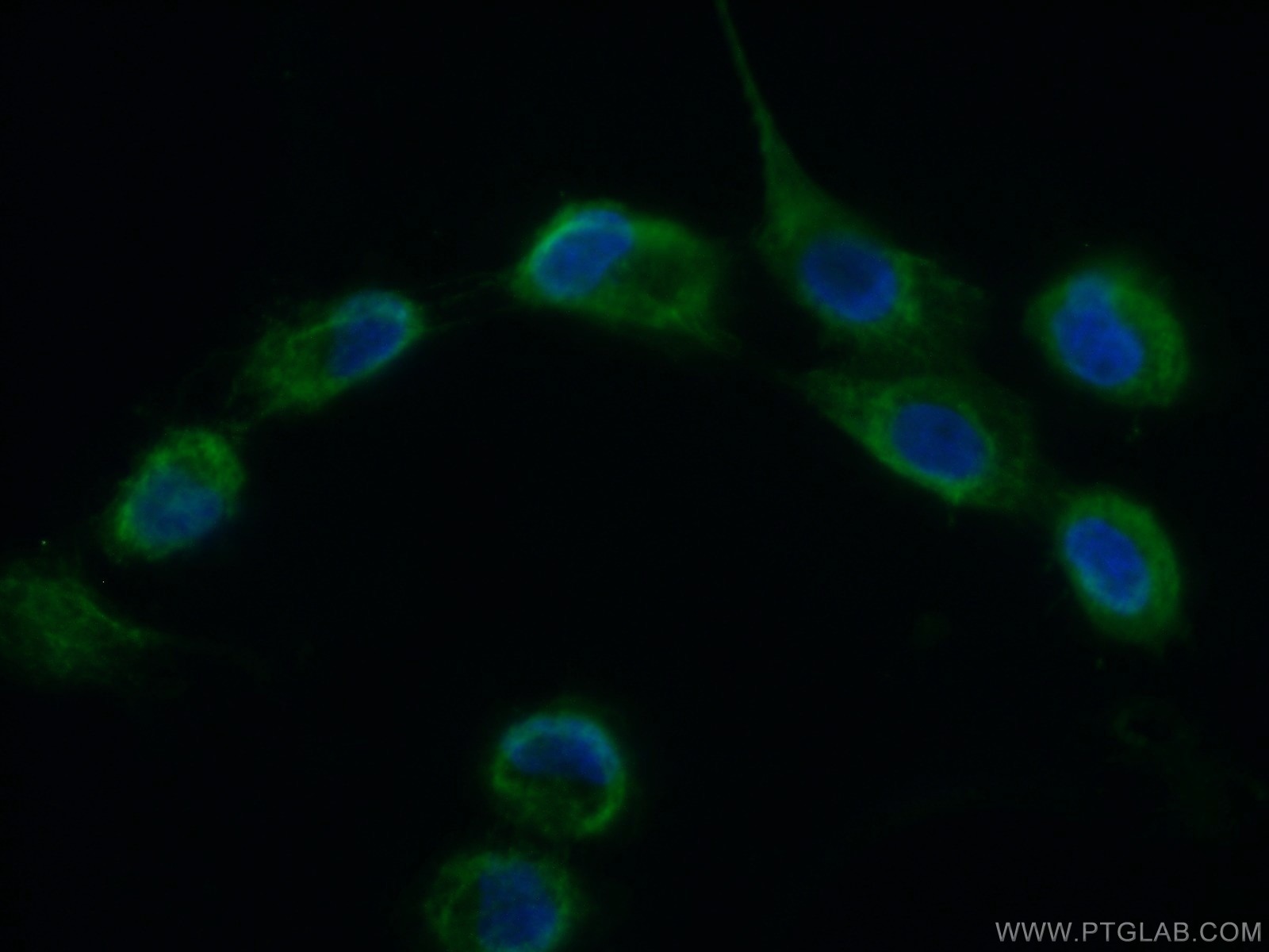 IF Staining of A431 using 11728-1-AP