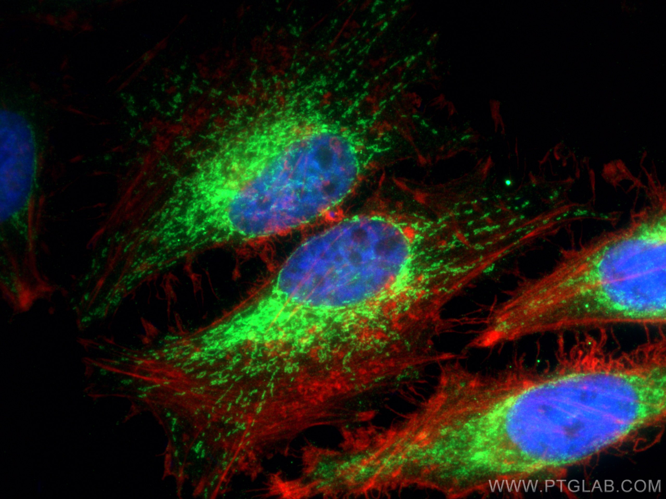 IF Staining of HeLa using 25671-1-AP