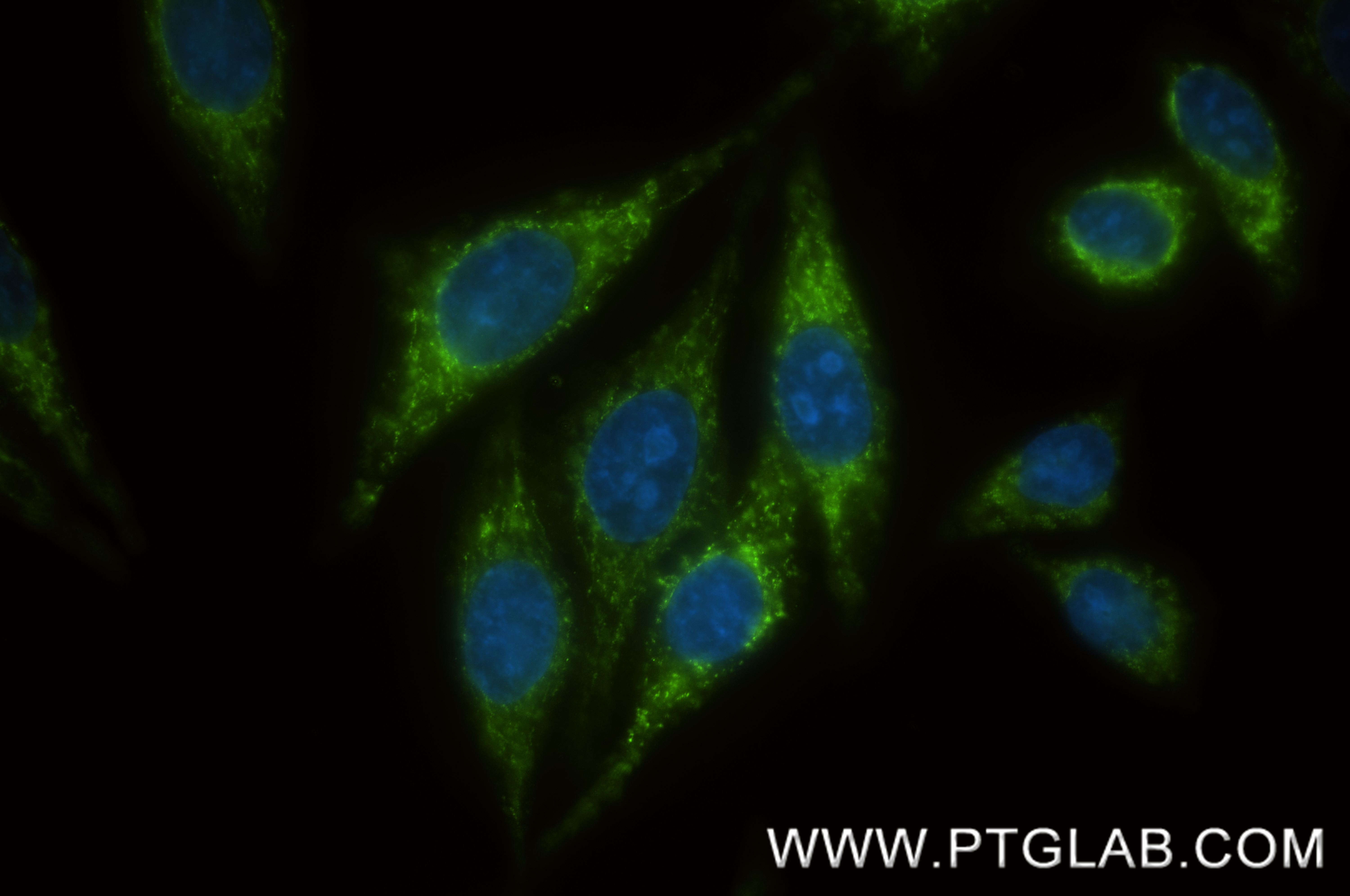 IF Staining of HepG2 using 87812-2-RR (same clone as 87812-2-PBS)