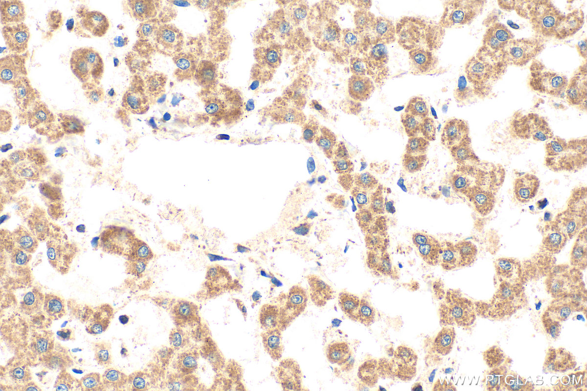 IHC staining of human liver using 25625-1-AP