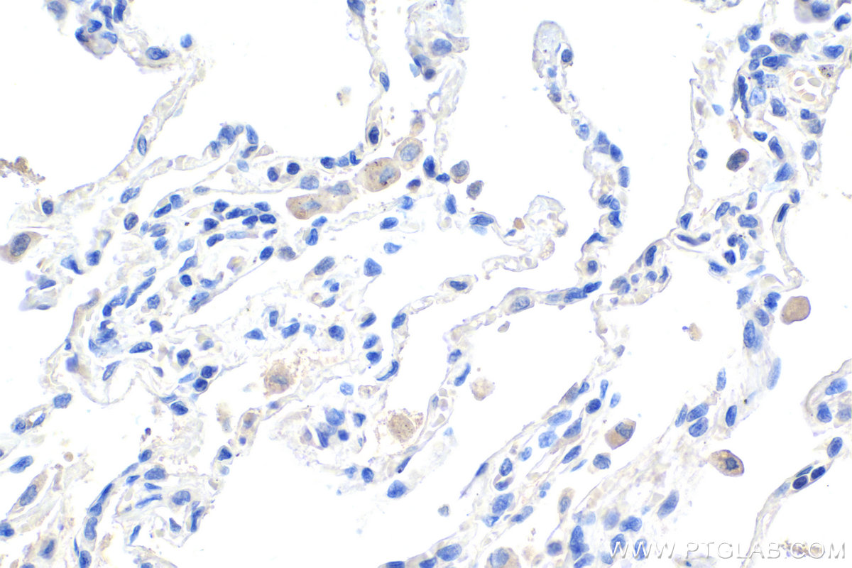 IHC staining of human lung using 68259-1-Ig