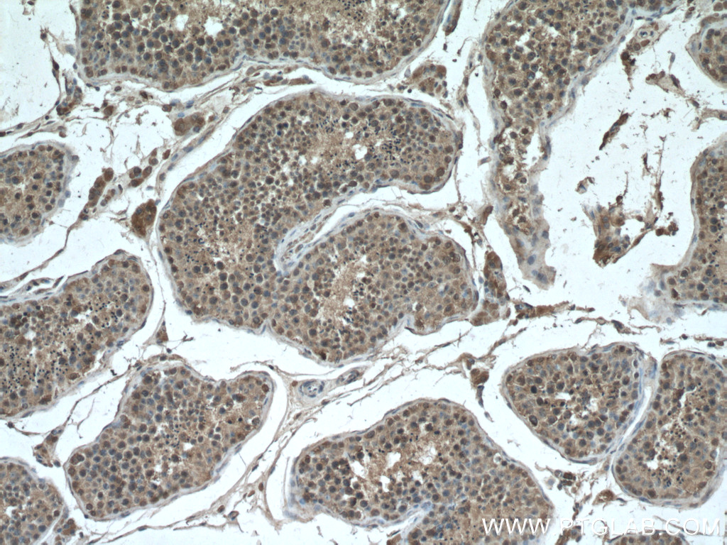 IHC staining of human testis using 66718-1-Ig