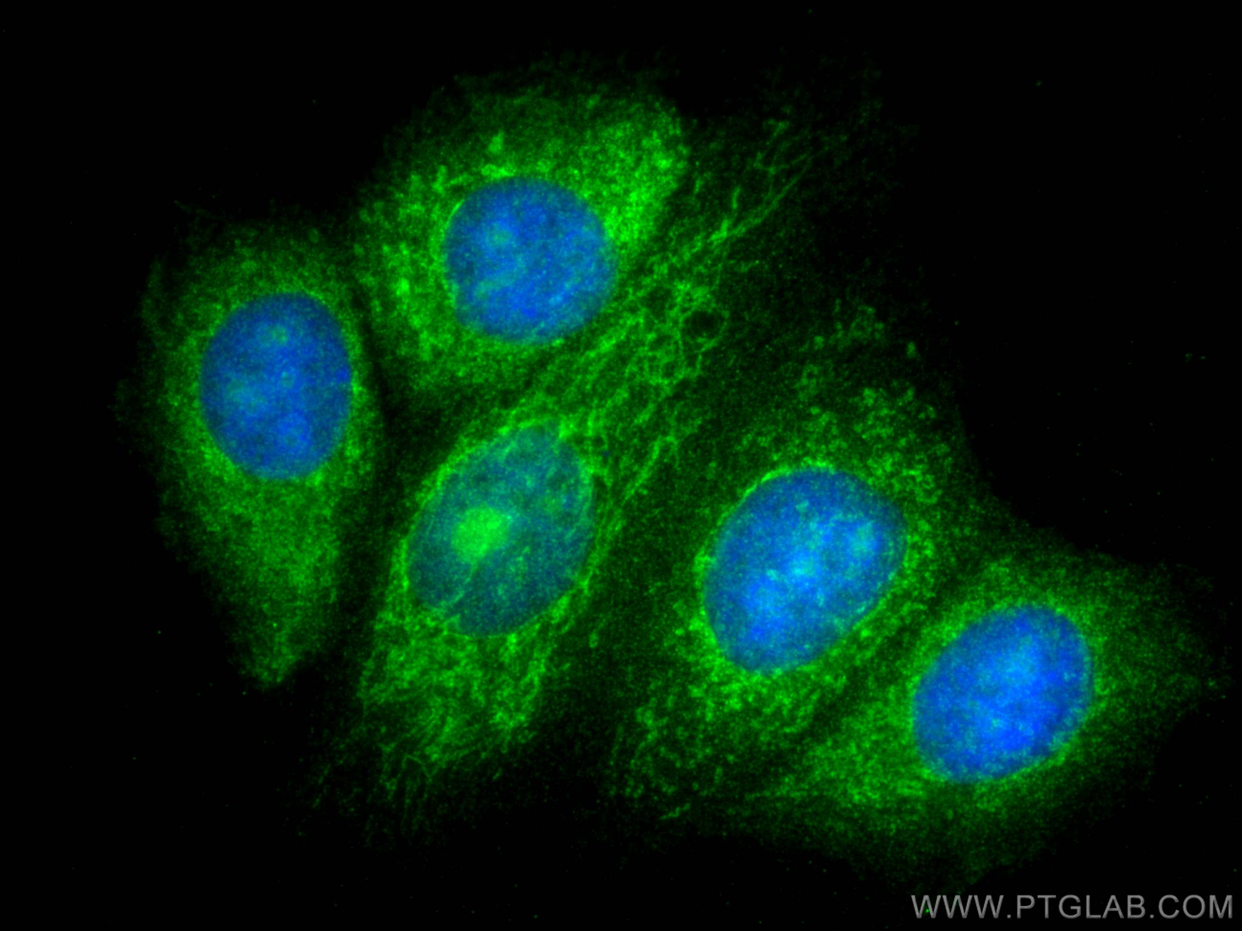 IF Staining of MCF-7 using 20639-1-AP