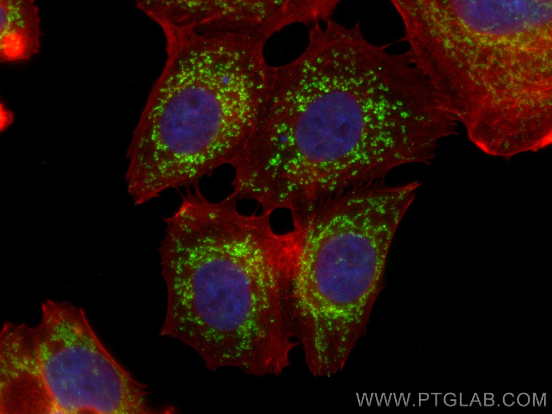 IF Staining of MCF-7 using 66597-1-Ig (same clone as 66597-1-PBS)