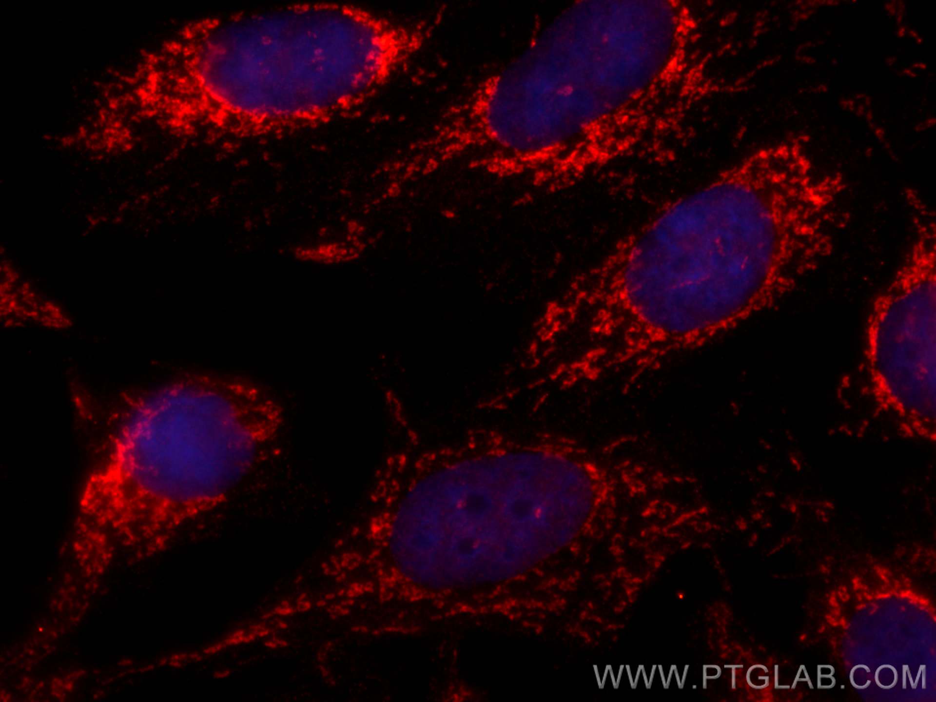 IF Staining of MCF-7 using CL594-66597