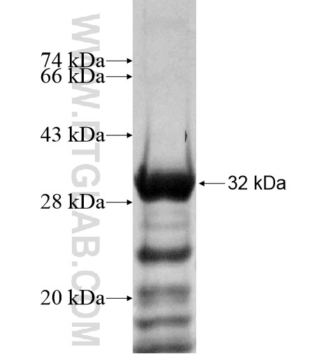 CHCHD6 fusion protein Ag15002 SDS-PAGE CHCHD6 fusion protein Ag15002 SDS-PAGE