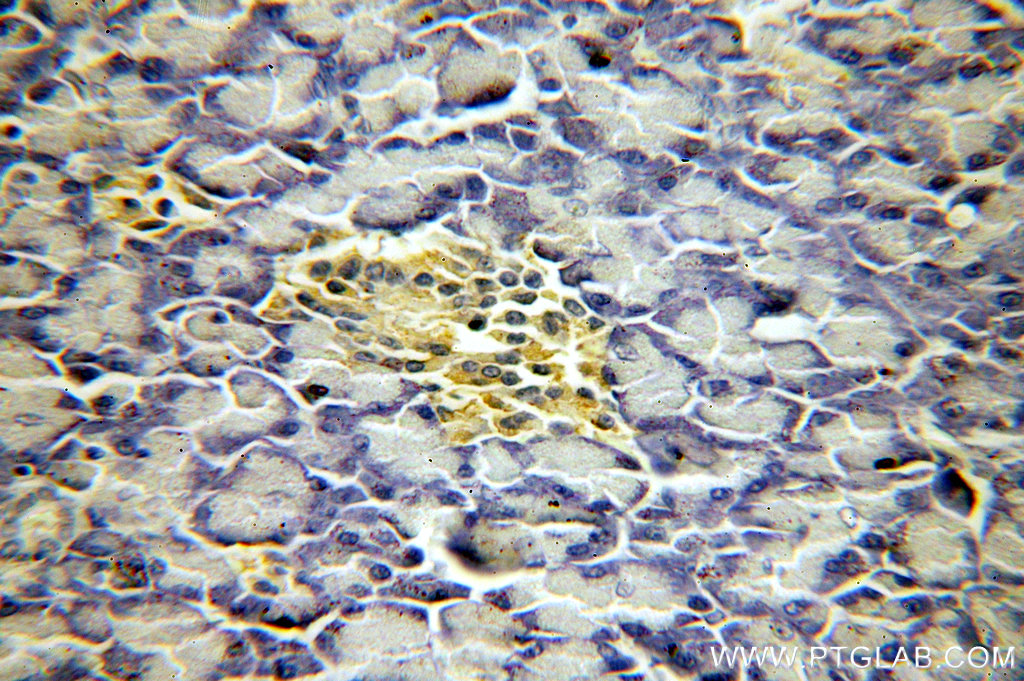 IHC staining of human pancreas using 19911-1-AP