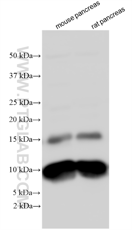 Various lysates were subjected to SDS PAGE followed by western blot with 19911-1-AP (CHCHD7 antibody) at dilution of 1:1500 incubated at room temperature for 1.5 hours. WB analysis using 19911-1-AP
