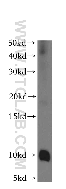 WB analysis of mouse pancreas using 19911-1-AP