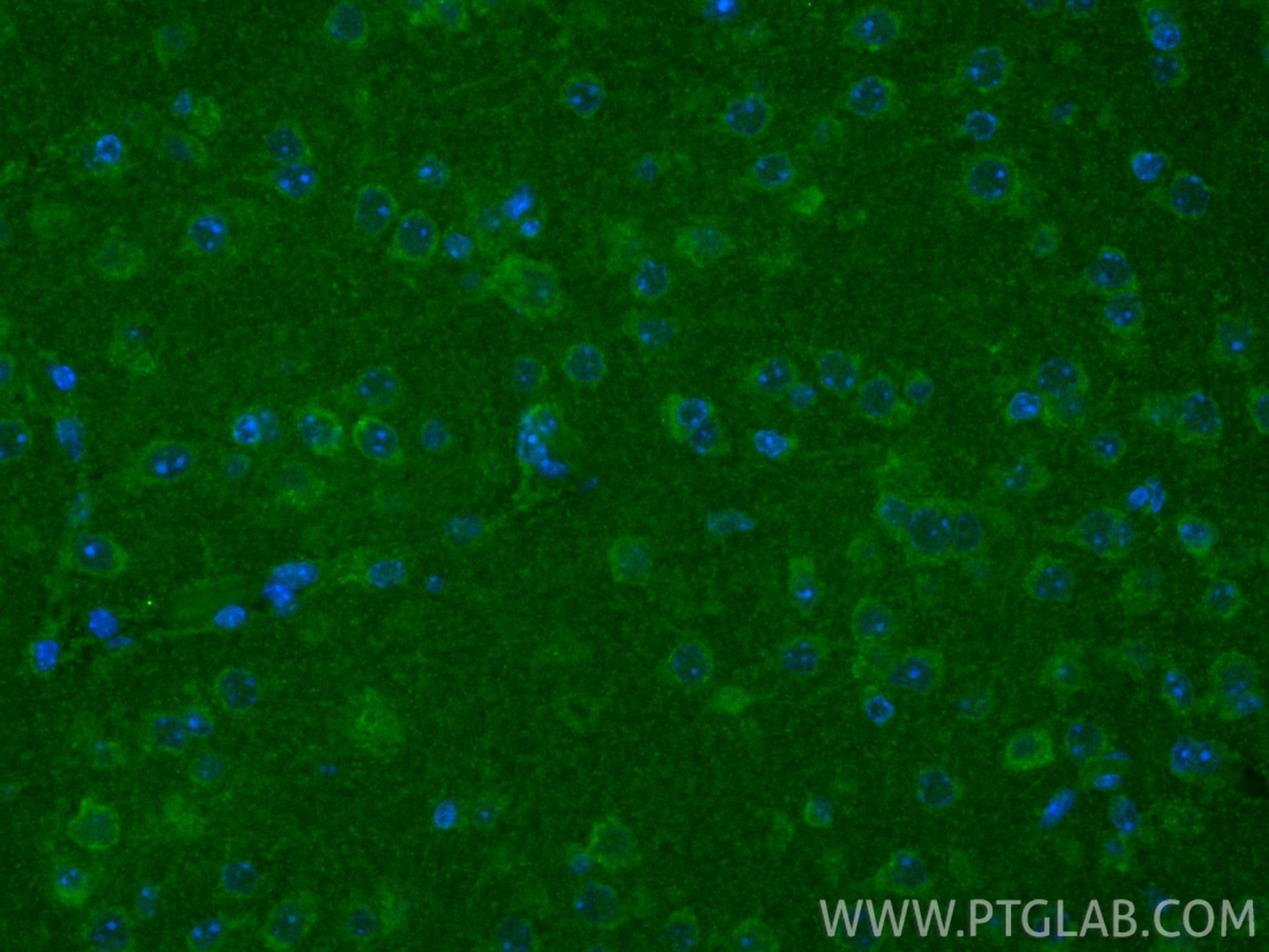 IF Staining of mouse brain using CL488-19911 IF Staining of mouse brain using CL488-19911