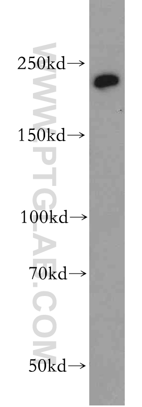 WB analysis of HeLa using 20576-1-AP