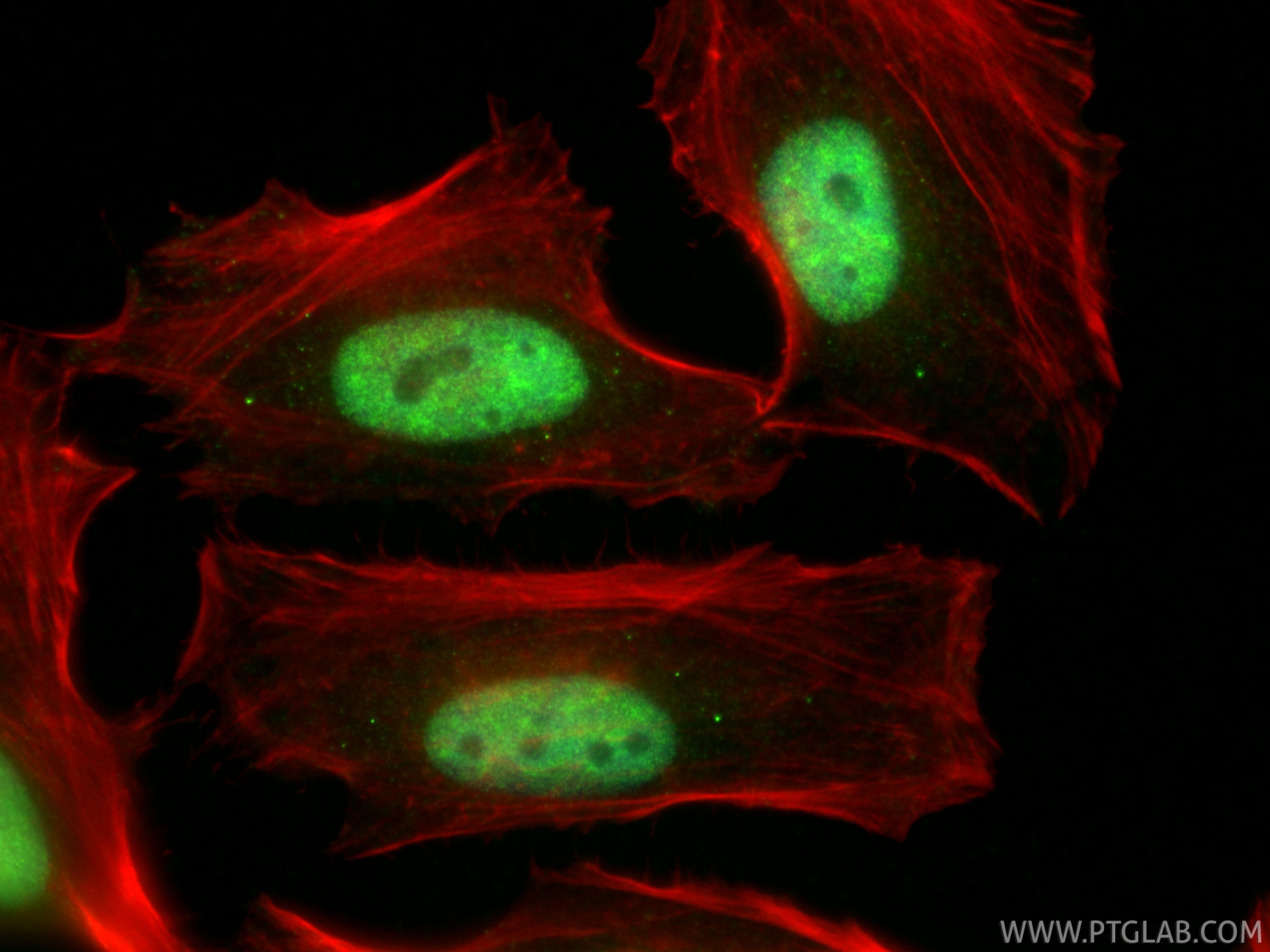 IF Staining of HeLa using 32923-1-AP