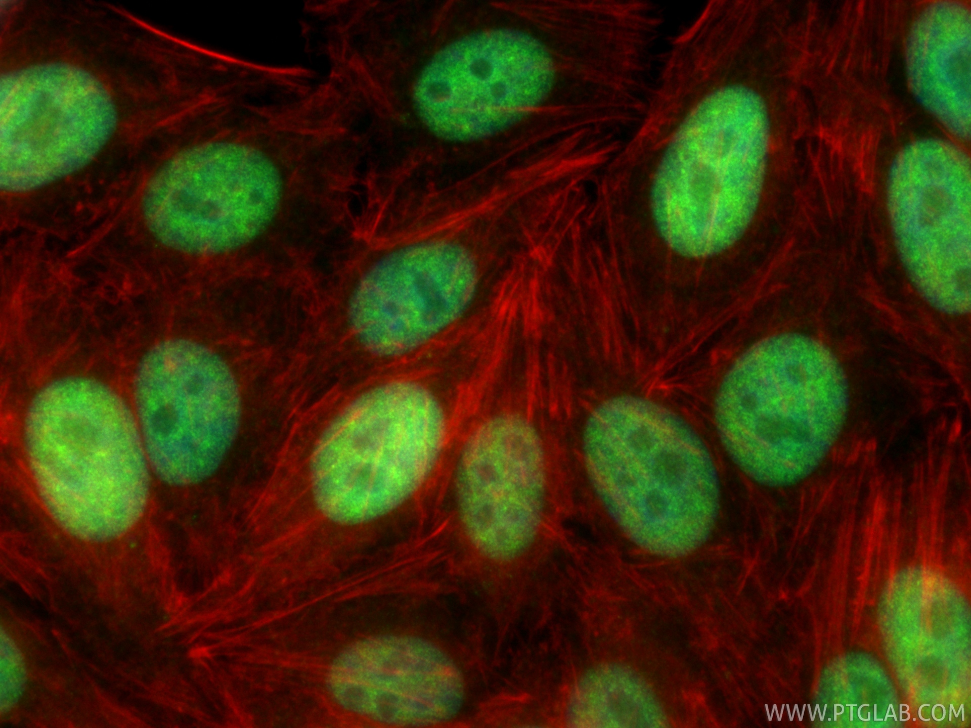 IF Staining of HepG2 using 32923-1-AP