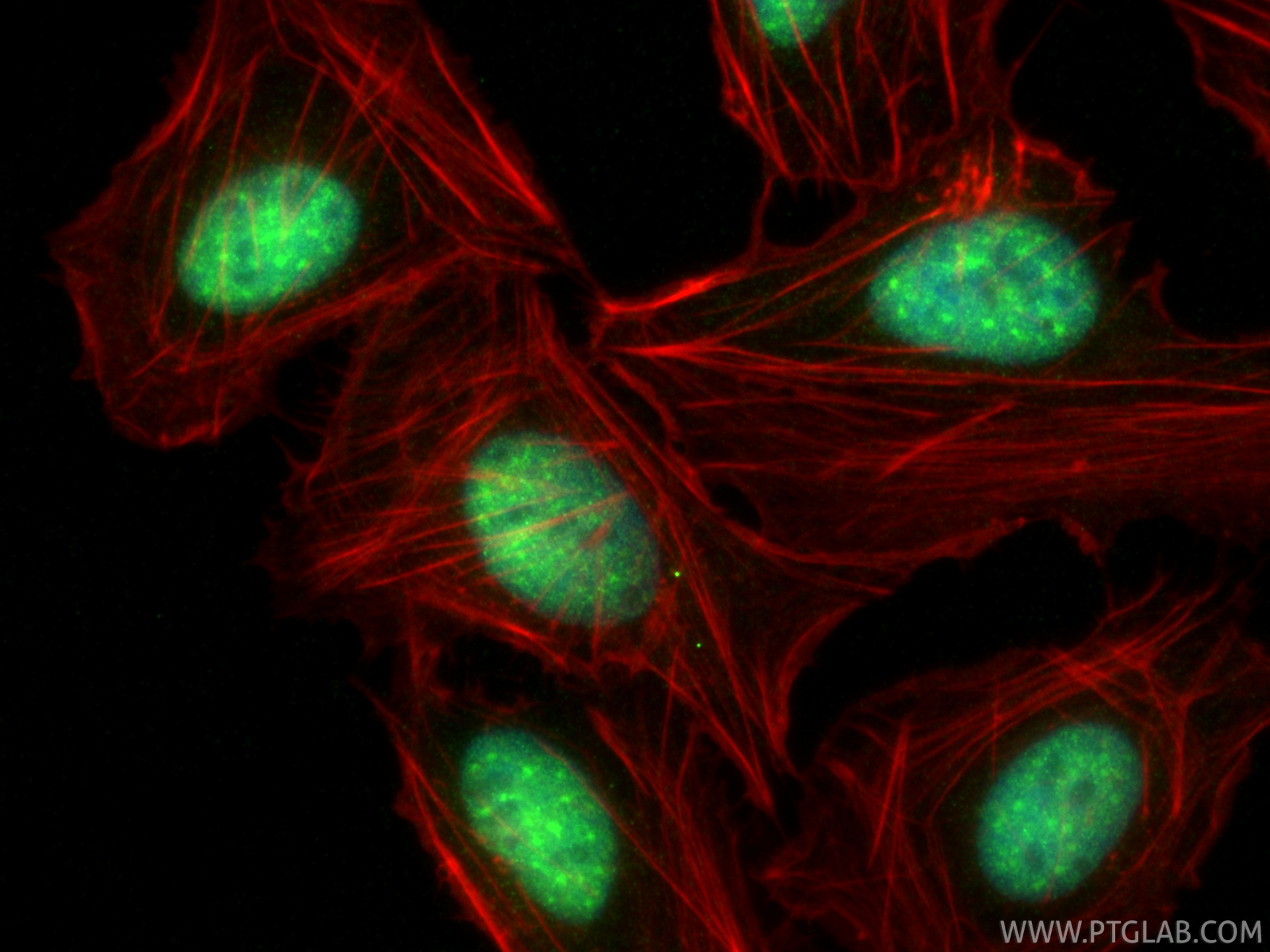 IF Staining of U2OS using 32923-1-AP