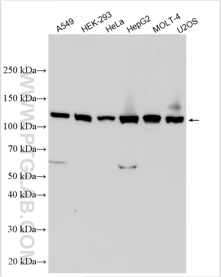 WB analysis using 32923-1-AP