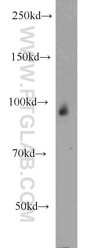 WB analysis of human placenta using 12311-1-AP
