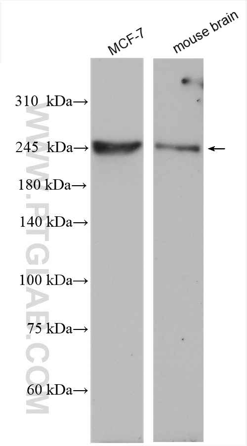 WB analysis using 25335-1-AP