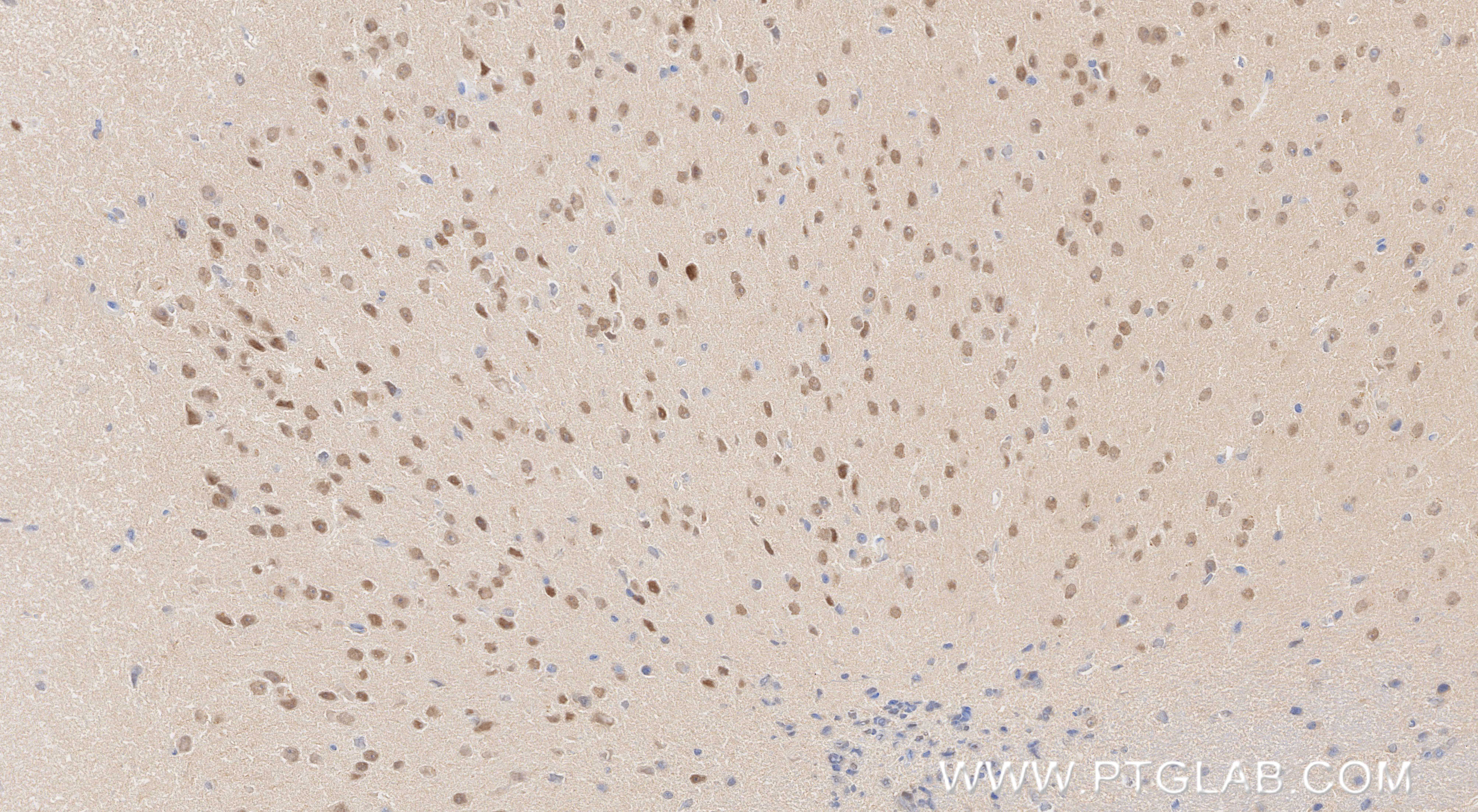IHC staining of mouse brain using 86077-2-RR