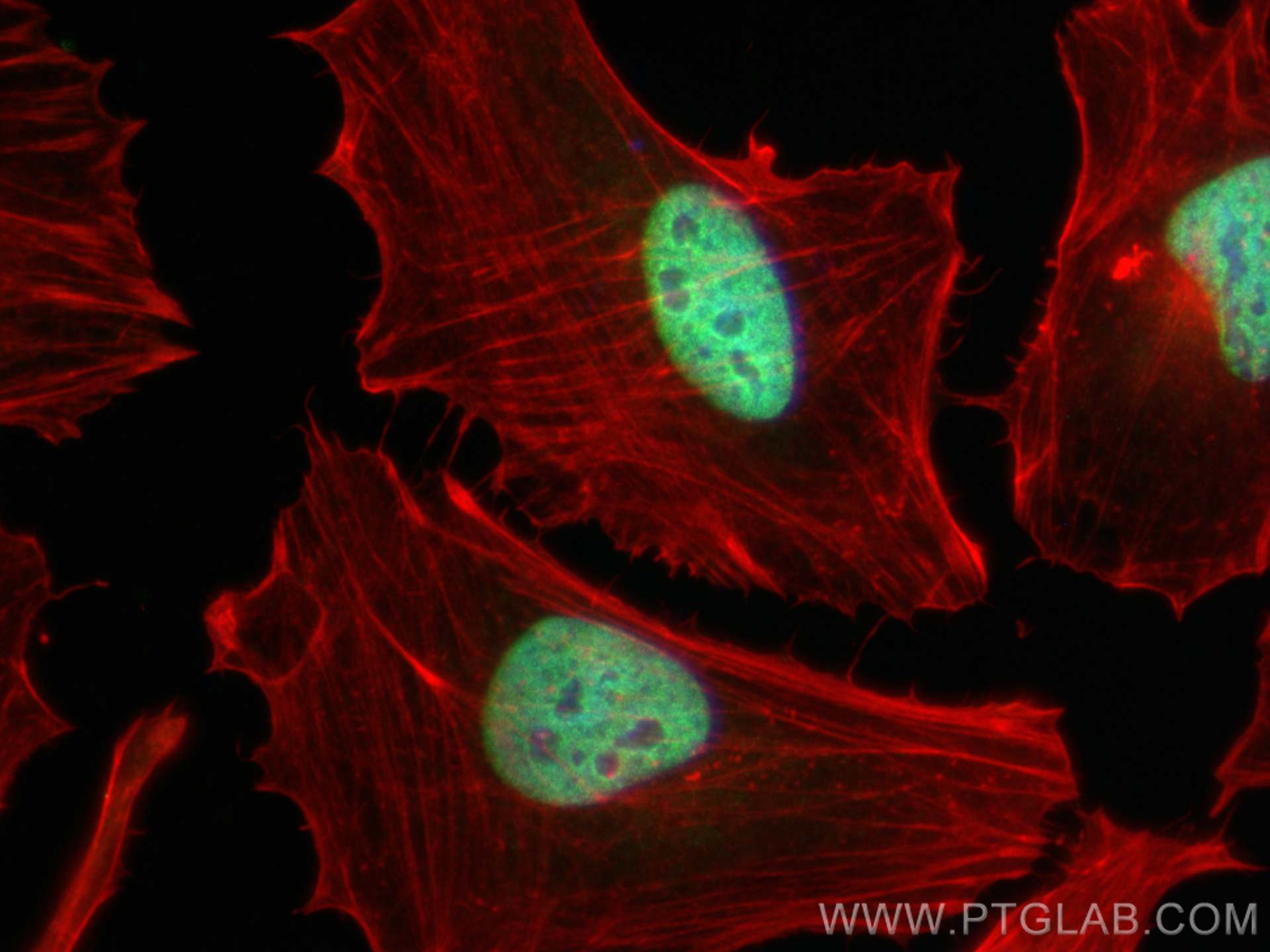 IF Staining of HeLa using 14173-1-AP