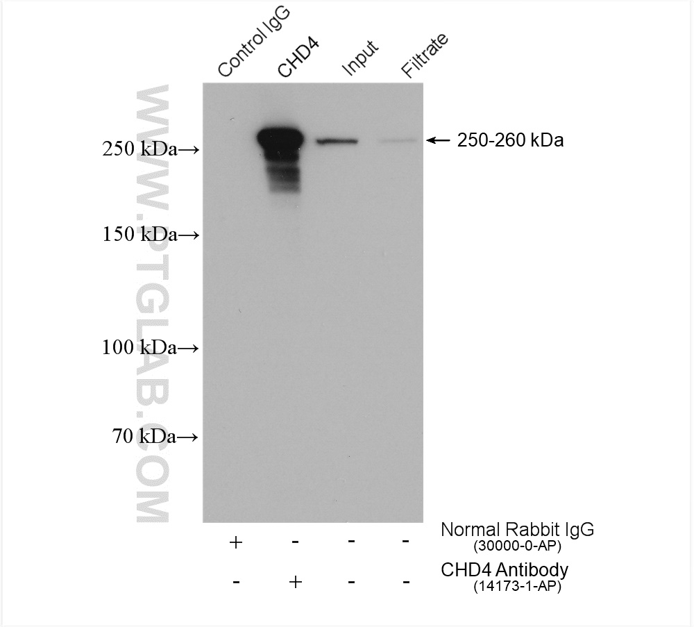 IP experiment of HeLa using 14173-1-AP