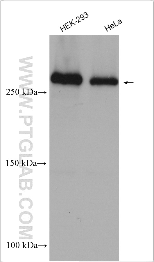 WB analysis using 14173-1-AP