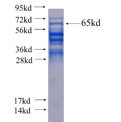 CHD4 fusion protein Ag5372 SDS-PAGE