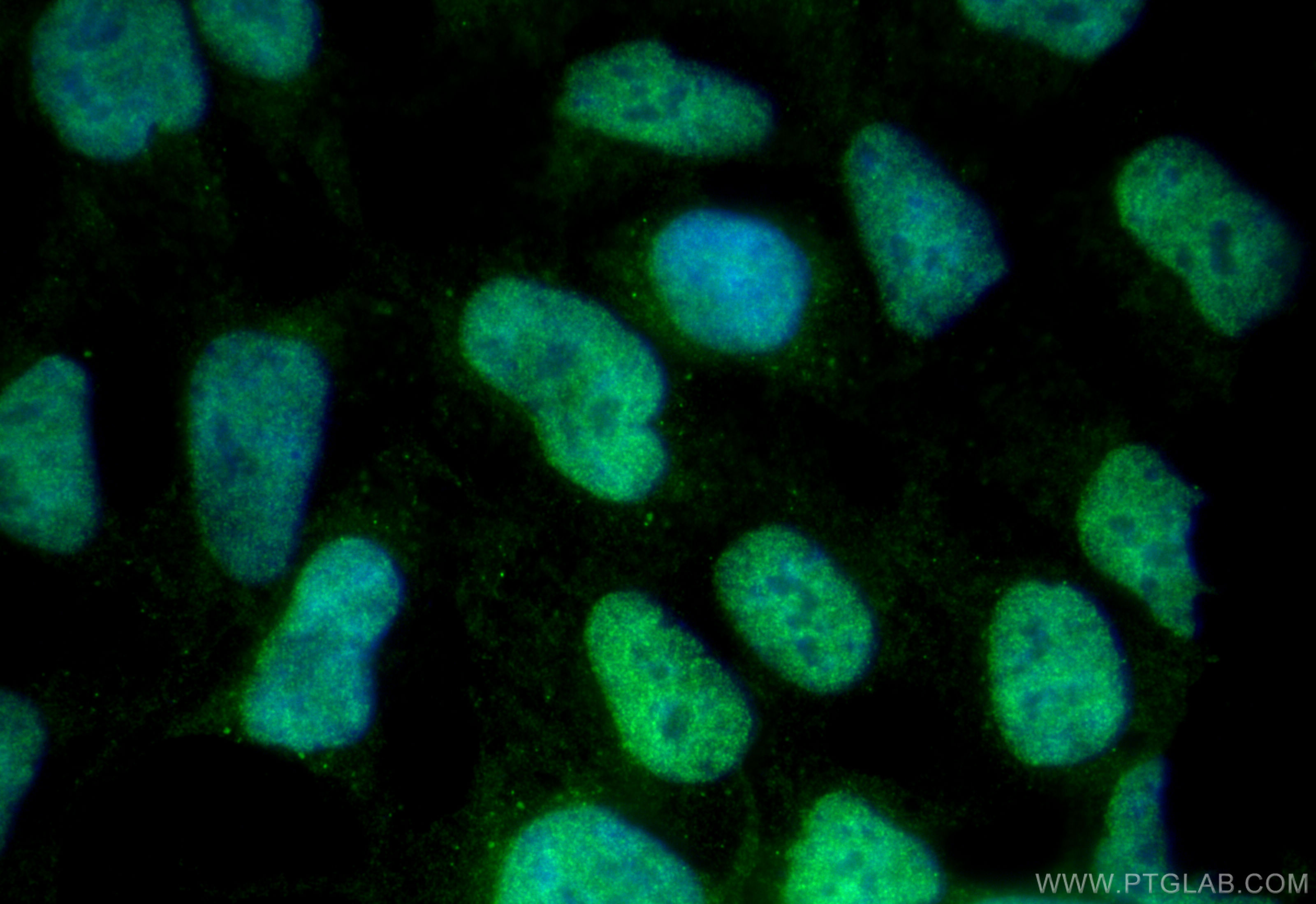 IF Staining of HEK-293 using 31919-1-AP