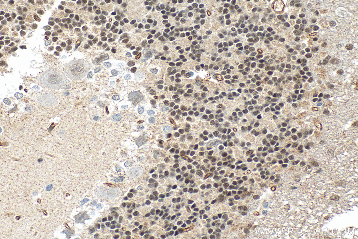 IHC staining of rat cerebellum using 31919-1-AP