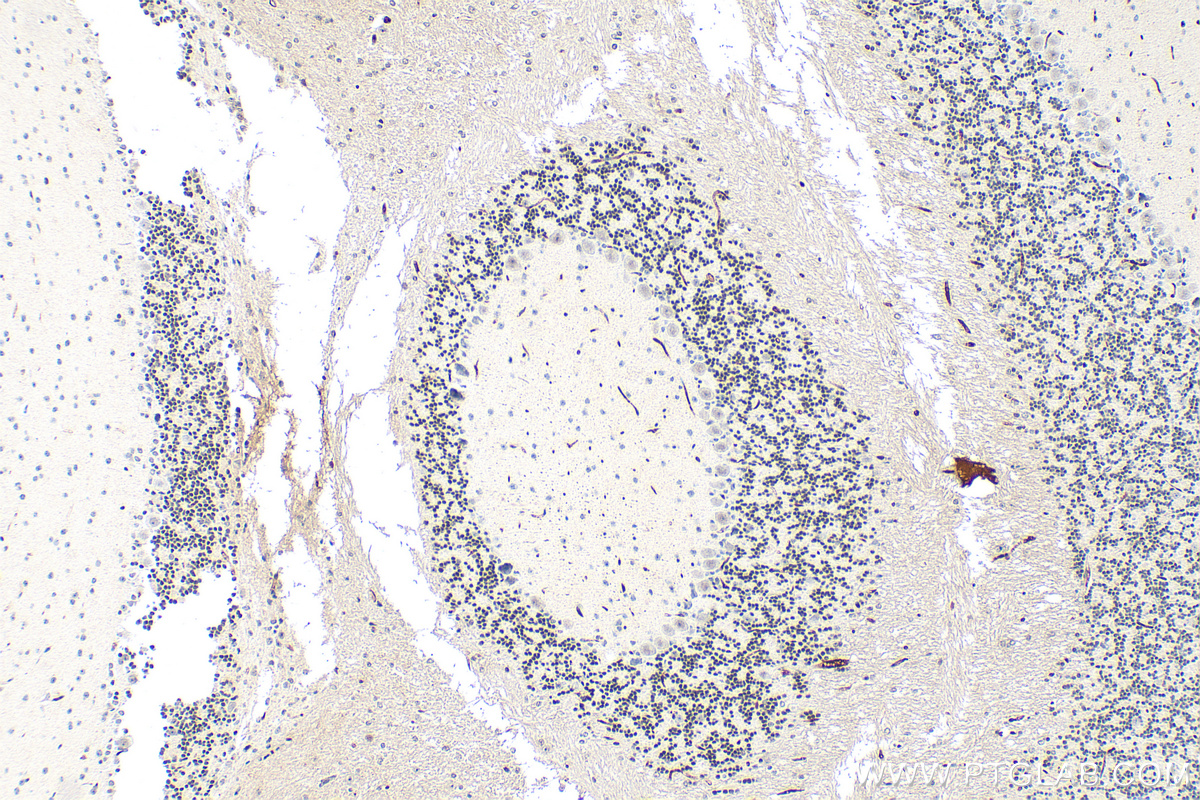 IHC staining of mouse cerebellum using 31919-1-AP