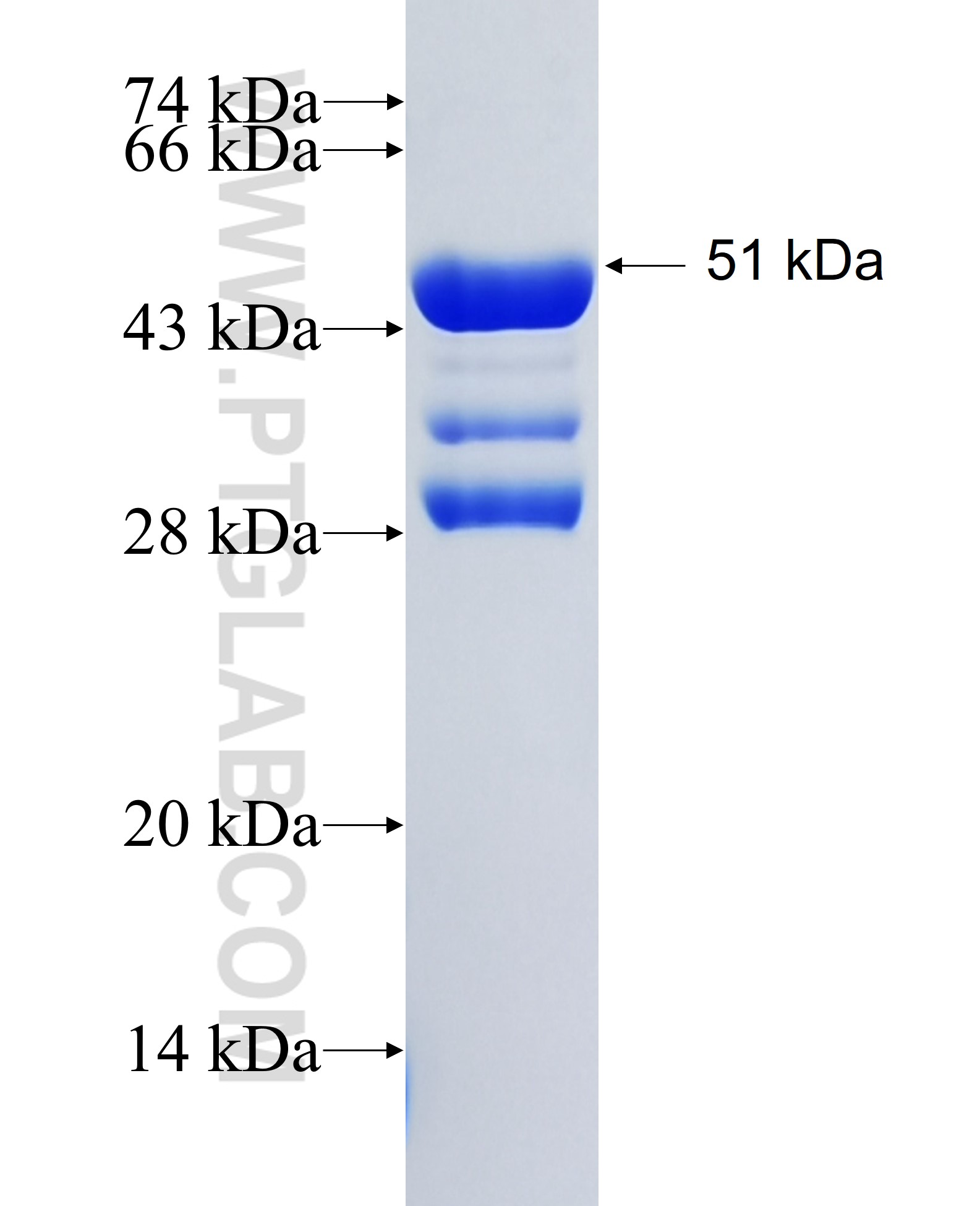 CHD7 fusion protein Ag36595 SDS-PAGE