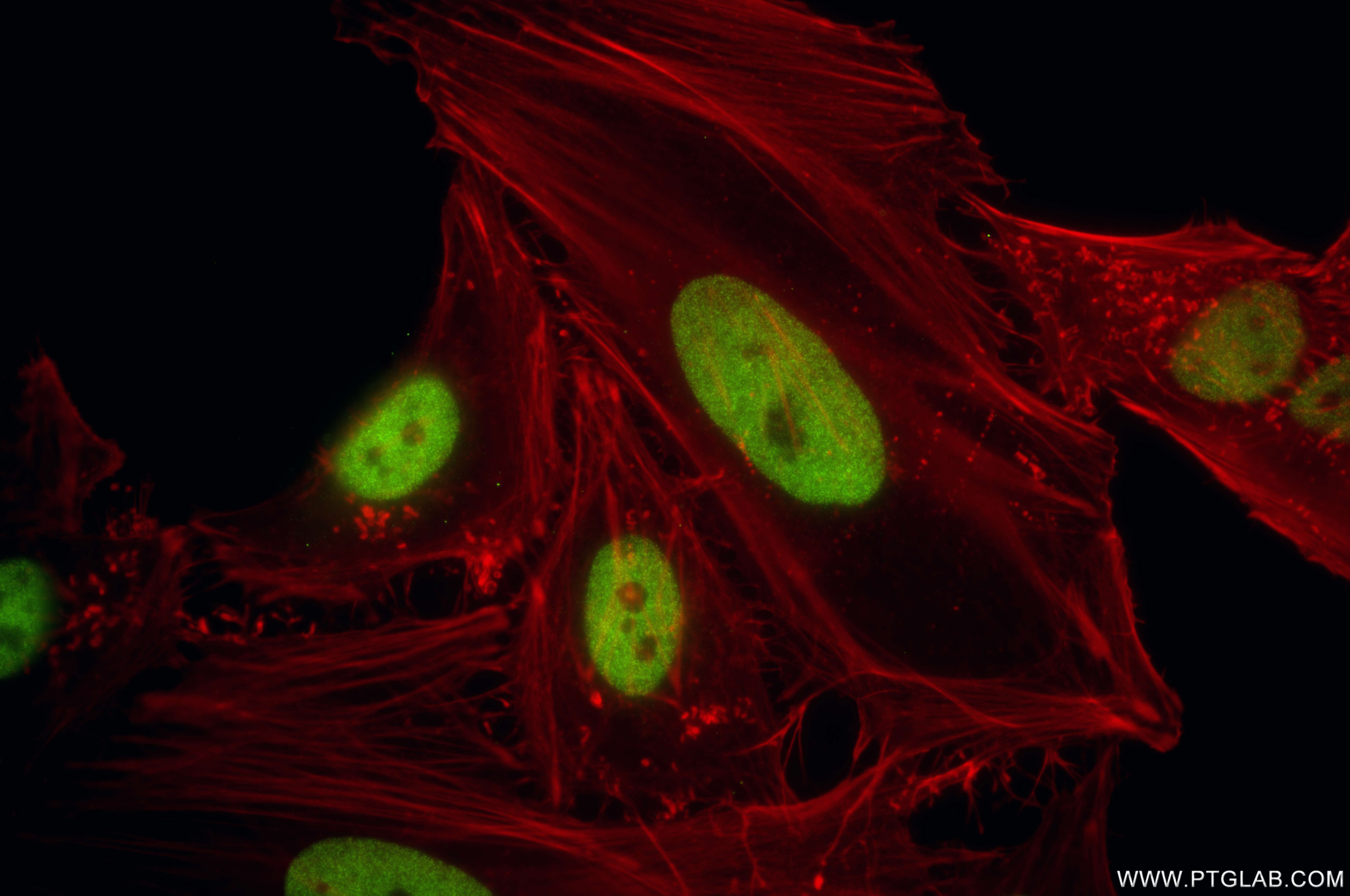 IF Staining of HeLa using 86032-1-RR (same clone as 86032-1-PBS)
