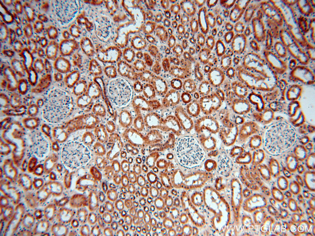 IHC staining of human kidney using 13402-1-AP (same clone as 13402-1-PBS)