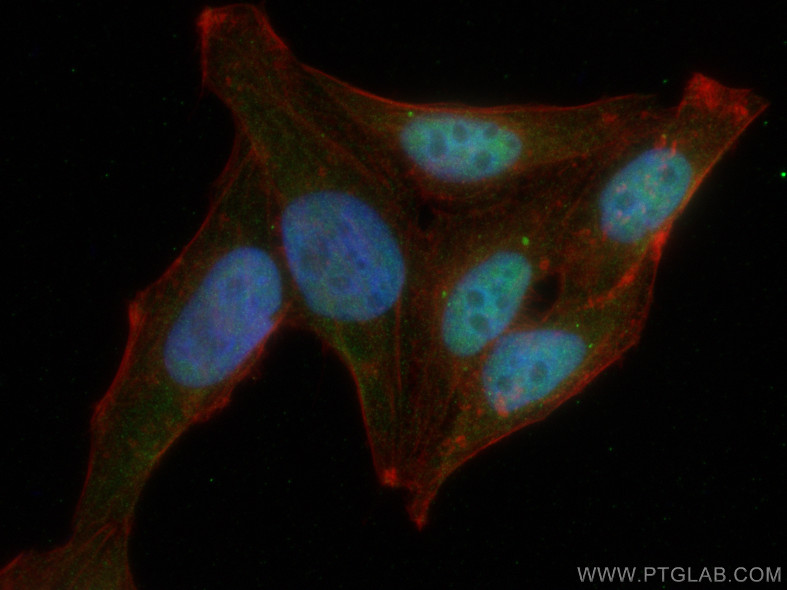 IF Staining of HepG2 using 13954-1-AP