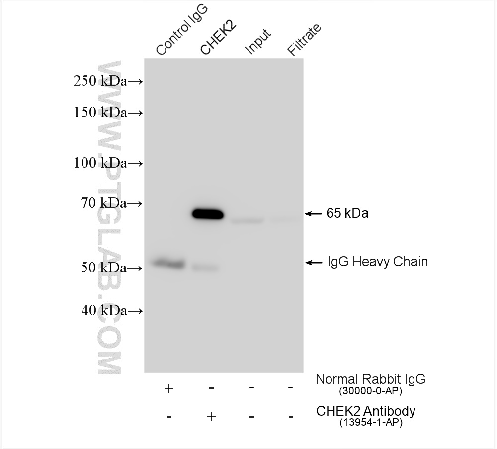 IP experiment of HeLa using 13954-1-AP