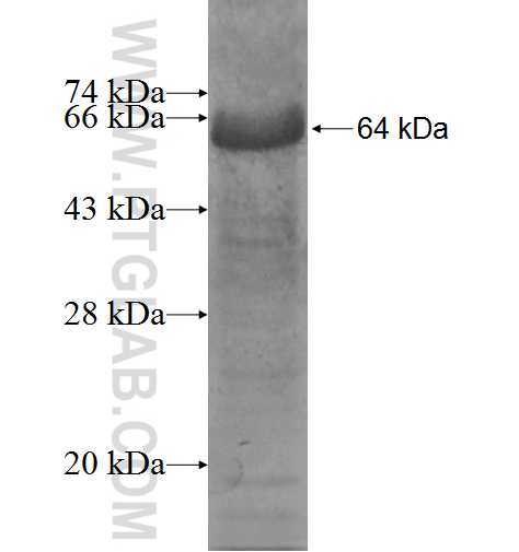 CHEK2 fusion protein Ag5195 SDS-PAGE CHEK2 fusion protein Ag5195 SDS-PAGE