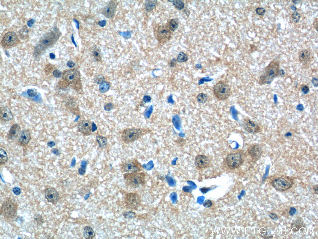 IHC staining of mouse brain using 25389-1-AP